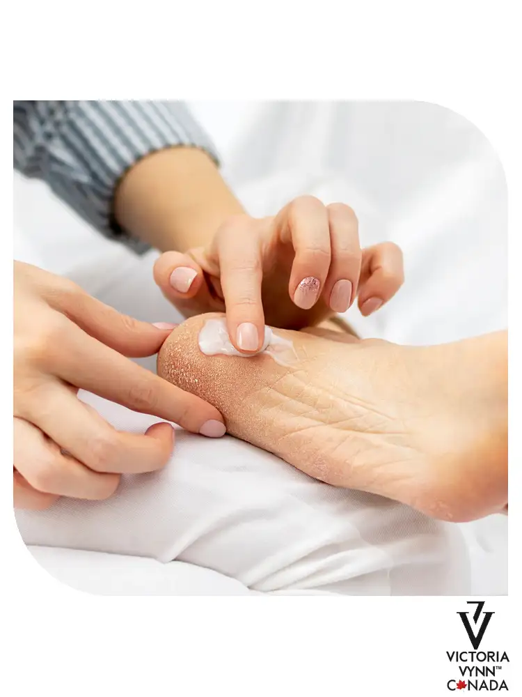 Pharm Foot best hand and body moisturizer for dry skin Ozone Oil o3 Concentre Butter