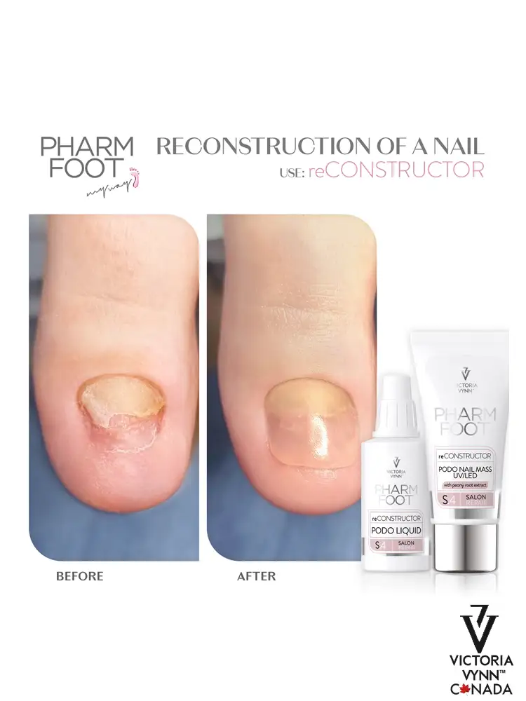 Pharm Foot pedicure toe reconstruction kit reCONSTRUCTOR 30ml